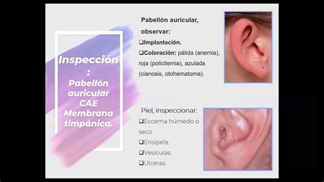 Semiología de Cabeza y Cuello YouTube