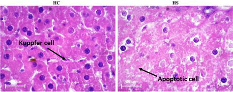 Confirmation Of Hepatic Steatosis By Hematoxylin And Eosin H E