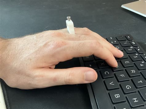 Gecko Splint Support For A2 Pulley Injury Finger Ligament Sprain