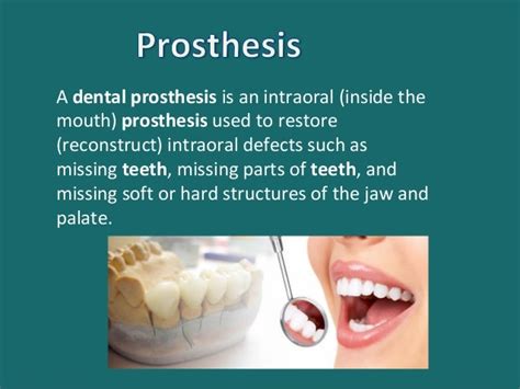 Different types of dental prosthesis