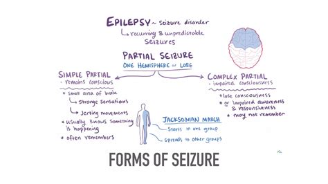 Seizure Localization Based On Semiology Ppt