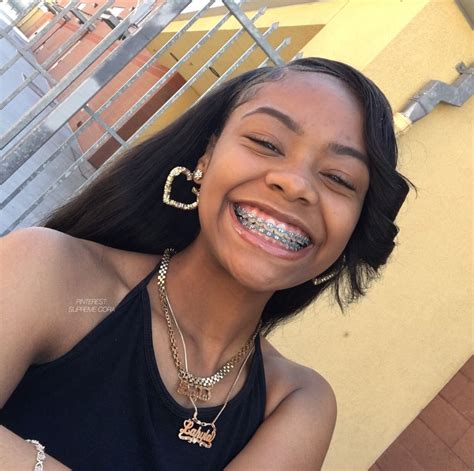 Pinterest Supreme Cora🎭 Cute Braces Cute Girls With Braces Braces