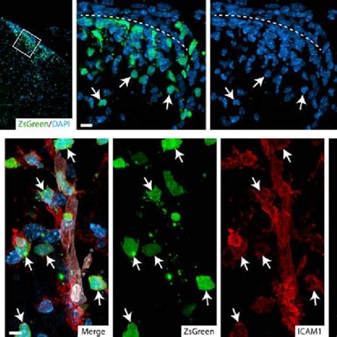 Icam And Icam Neutrophils Are Differently Distributed In The Spinal