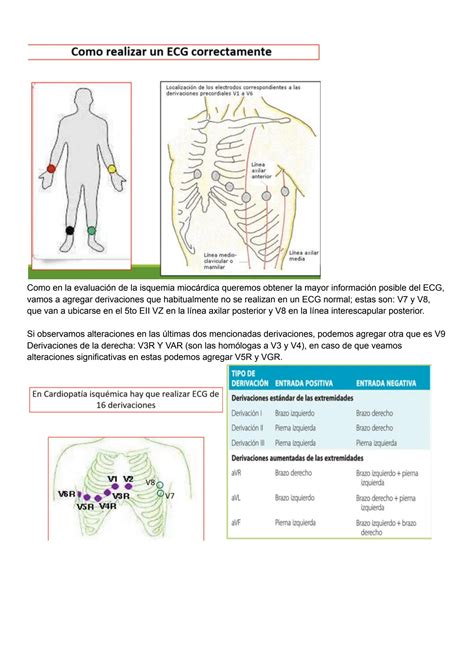 Solution Electrocardiograma En Cardiopat A Isqu Mica Studypool