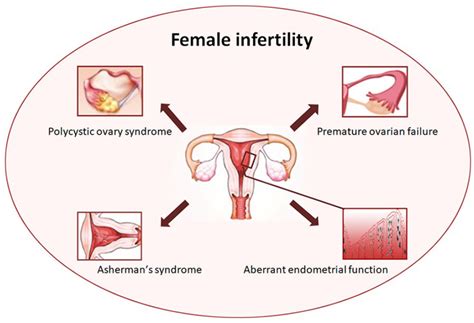 Stem Cell Therapies For Human Infertility Advantages And Challenges