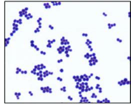 Gram Stain Flashcards Quizlet