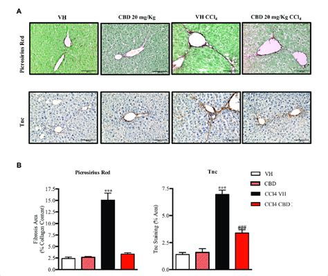 Cbd Reduces Liver Fibrosis Induced By Ccl4 A Representative Images