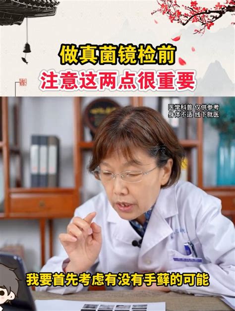 做真菌镜检前要注意什么？这两点要谨记！ 度小视