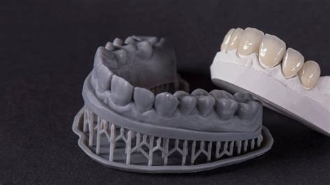 Qué es CAD CAM dental Blog UE