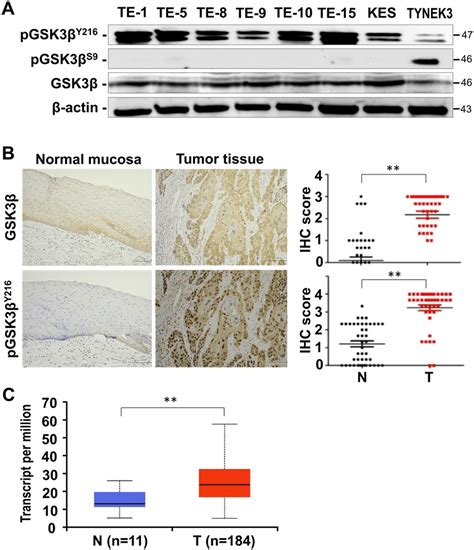 Comparative Analysis For The Expression And Phosphorylation Of Gsk3β In