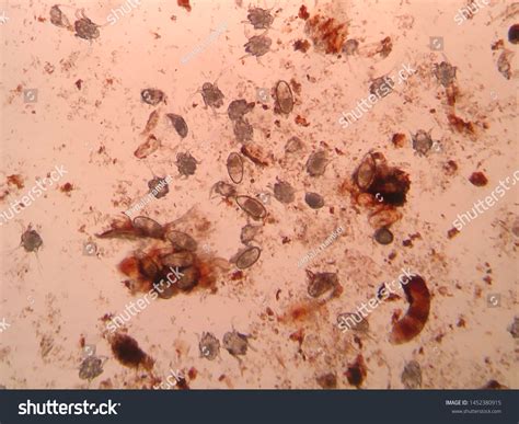 Ear Mite Eggs