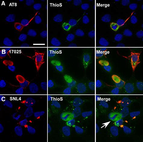 Induction Of Intracellular Tau Aggregation Is Promoted By α Synuclein