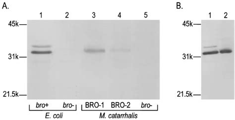 Immunoblot Analysis Of Bro ␤ Lactamase Expressed By M Catarrhalis And