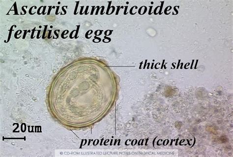 Ascaris Lumbricoides Eggs Wm Microscope Slide Diagnosis Ova In Porn