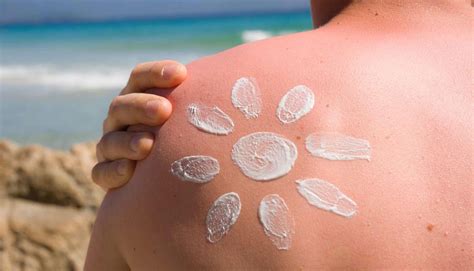 How To Relieve Sunburn Aquaviews