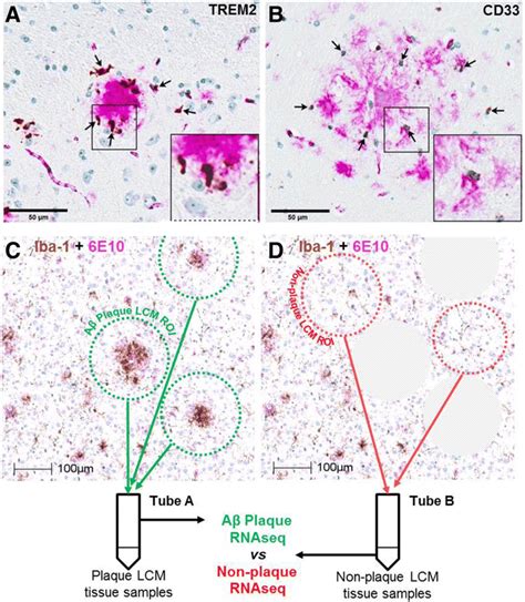 Localization Of Trem2 And Cd33 Around Amyloid Beta Aβ Plaques In The