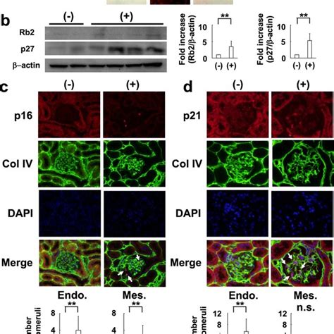 Expression Of P16 And P21 Induced By The Activation Of The Tgf β1 Smad3