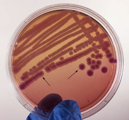 Biol Lab Manual Klebsiella Aerogenes On Macconkey Agar