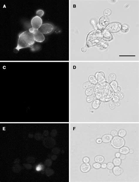 Binding Of Gm1 To Yeast Forms Of P Brasiliensis Suspension Of P