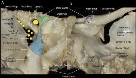 Orbital Surface Of Sphenoid