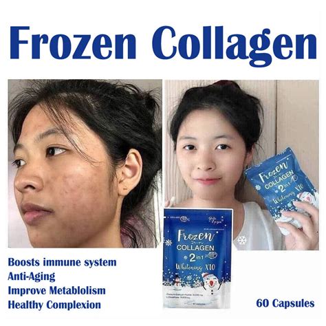 Frozen Collagen In With L Glutathione Whitening X Pack Of