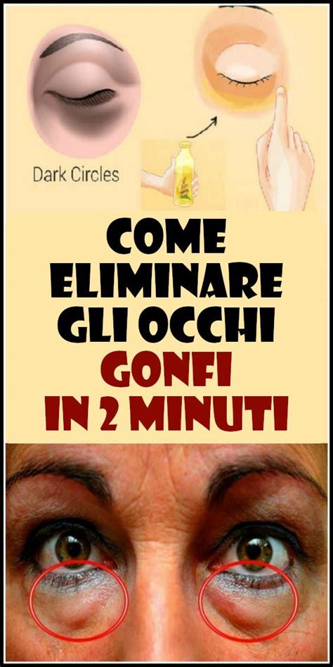 Come Eliminare Gli Occhi Gonfi In 2 Minuti Rimedi Per La Salute Consigli Di Bellezza Fai Da