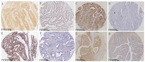 Association Of KRAS NRAS BRAF And PIK3CA Gene Mutations With