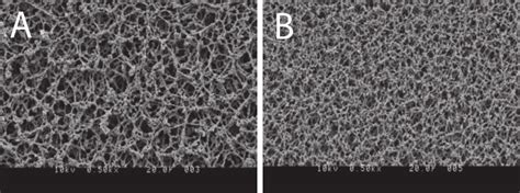 Scanning Electron Micrograph Of An Ae 100 Unbacked Nitrocellulose