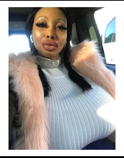 The prolapsed look is so hot right now : r/Botchedsurgeries