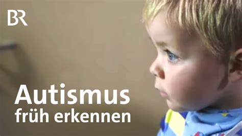 Autismus Aussehen Asperger Syndrom Symptome Ursachen Therapie