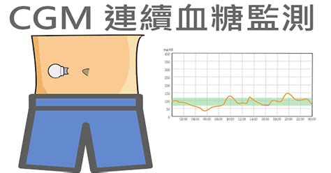 圖解cgms連續血糖監測系統的原理及使用情境 控糖筆記專業圖解糖尿病及甲狀腺衛教網站