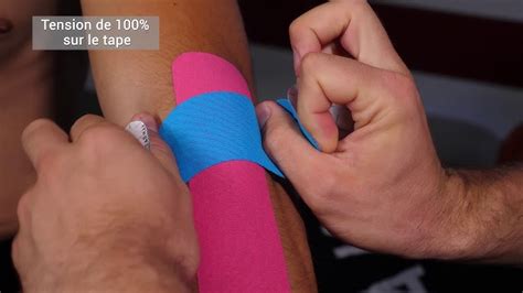 How To Apply Kinesiology Taping For Tennis Elbow Lateral