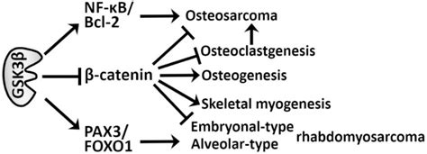 Glycogen Synthase Kinase 3β Biology In Bone And Soft Tissue Sarcomas