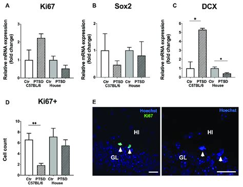 Effect Of Single Prolonged Stress On The Level Of Neurogenesis In The Download Scientific