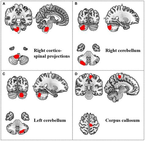 Frontiers Effect Of Acupuncture On The Modulation Of Functional Brain