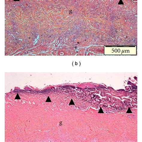 Representative Photomicrographs Of Tissue Sections At Day After Burn