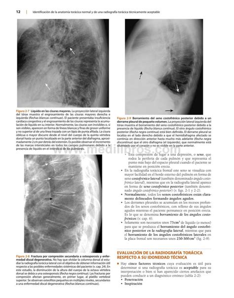 Herring Radiologia Basica Aspectos Fundamentales Pdf