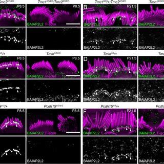 Baiap L Is Absent From Stereocilia Tips In Transduction Mutants