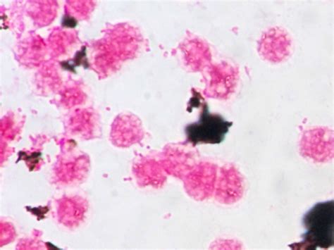 Salmonella Enterica Gram Stain