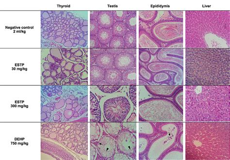 Effects Of Talinum Paniculatum Jacq Gaertn Leaf Extract On General