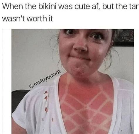 35 Funny Sunburn Memes That'll Have You Reaching For The Sunscreen ...