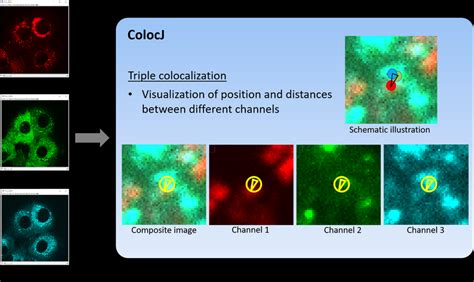 Visualization Of Spatial Composition For Triple Colocalization Using