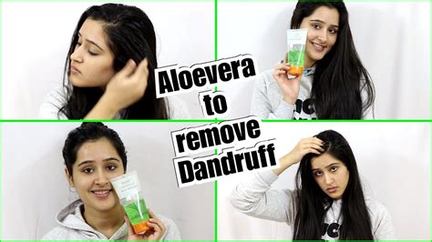 Top 176 + Aloe vera for dandruff hair - polarrunningexpeditions