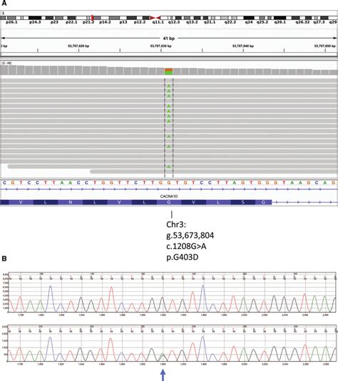 A An Integrative Genomics Viewer Igv Screenshot Showing The