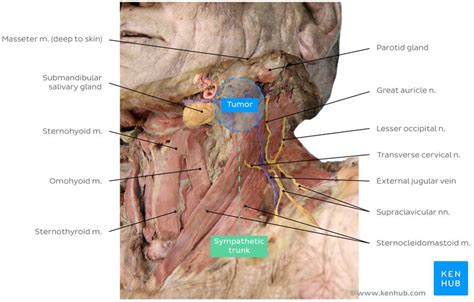 Horner's syndrome: Clinical case and images | Kenhub