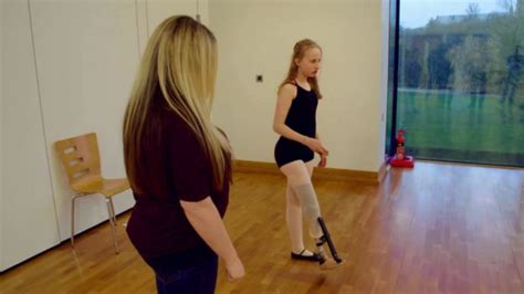 Amputee Ballet Dancer Appeals For En Pointe Prosthetic Foot Bbc News