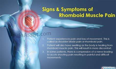 Rhomboid Muscle Pain Causes Symptoms Treatment Relief Exercises Prevention The Healthy Apron