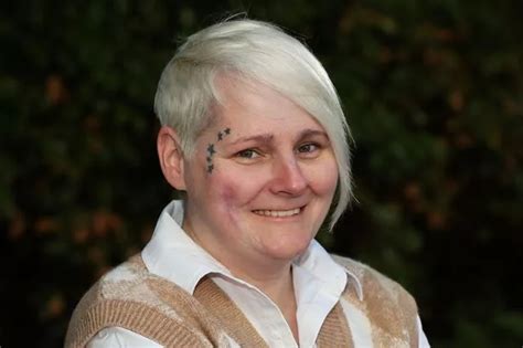 Disabled Girl 18 Scarred For Life As Boiling Hot Water Bottle