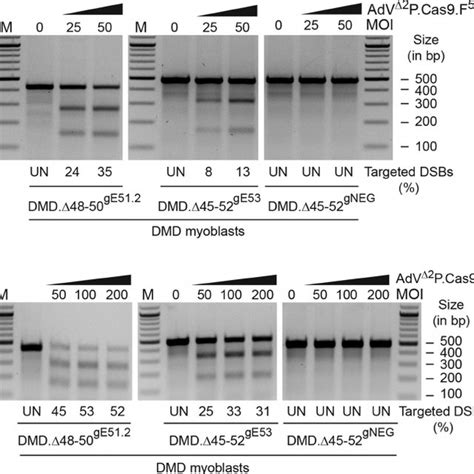 Dystrophin Western Blotting On Myotubes Differentiated From Dmd