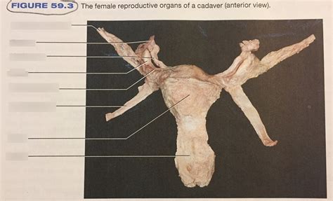 Suspensory Ligament Of Ovary Cadaver